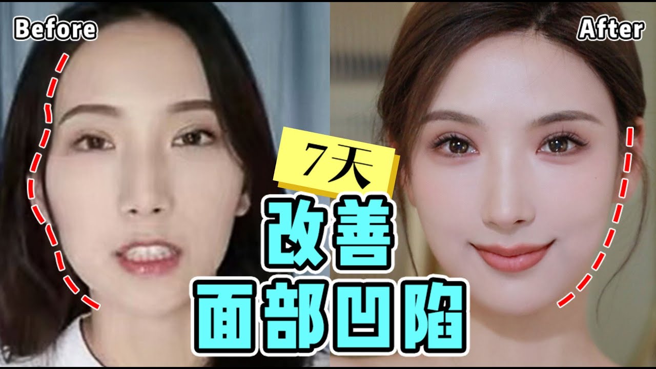 【Improve Facial Sunkenness】太阳穴凹陷、颧骨突出、脸颊凹陷，不仅显老，还没有亲和力！7天改善面部面颊凹陷！有效改善菱形脸的面部肌肉训练！面部瑜伽使脸部肌肉丰盈饱满！