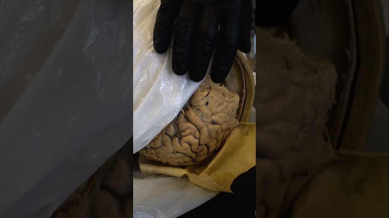 Spider-Like Tissue That Wraps the Brain #science #brain