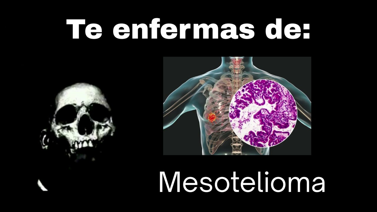 Mr Increíble Perturbado - Te Enfermas De Esta Grave Enfermedad 🤒💊🦟
