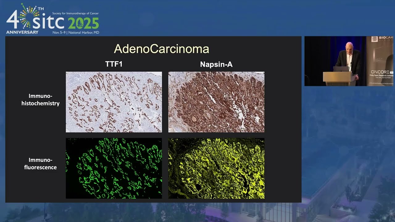 SITC 2025  - From Spatial Biology to Clinical Utility:  Advancing Lung Cancer Diagnostics