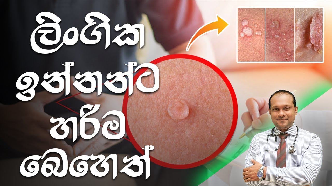 ලිංගික ඉන්නන්ට හරිම බෙහෙත් - @behethbydrnamal