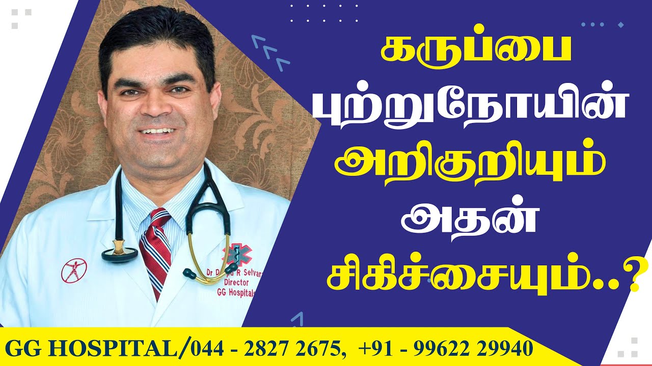 CANCER OF THE OVARY!!!