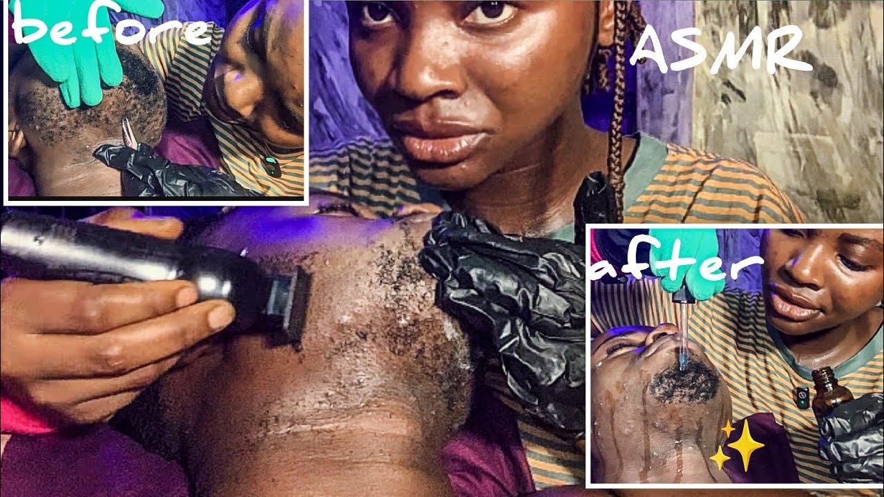 ASMR ✨Deep Ingrown Hair Extractions with a clean Shave 🧔& Healing Cleanse🧒 like Mariam ASMR 🥰
