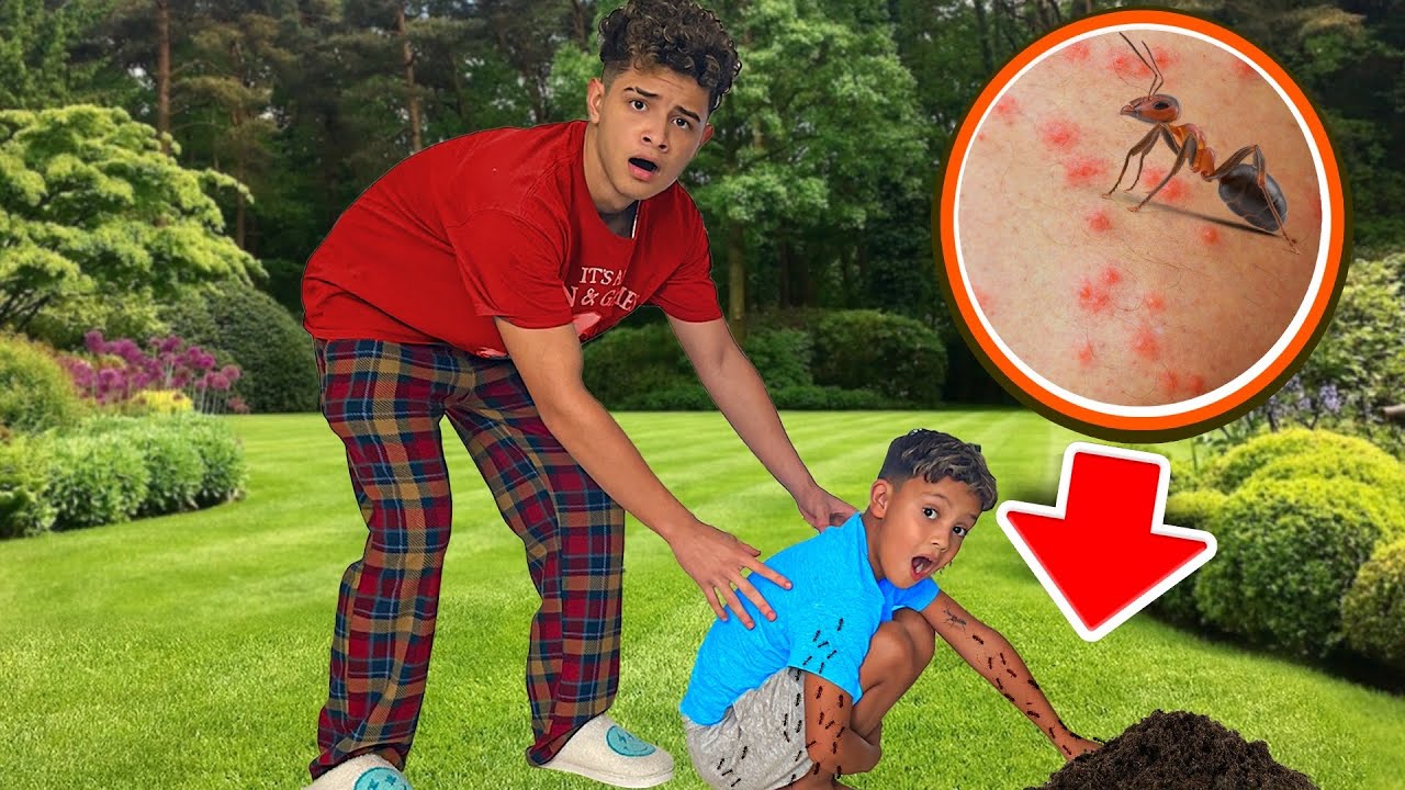 OUR SON Got STUNG By Fire Ants