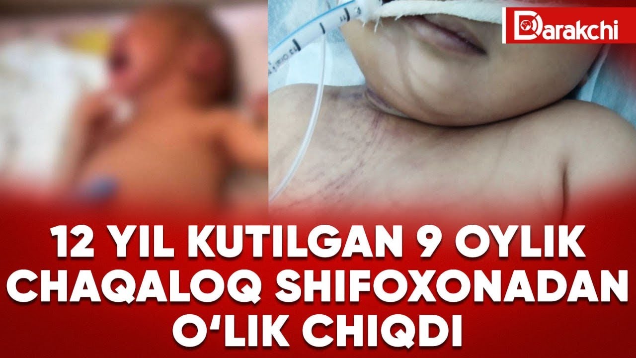 12 YIL KUTILGAN 9 OYLIK CHAQALOQ SHIFOXONADAN O‘LIK CHIQDI