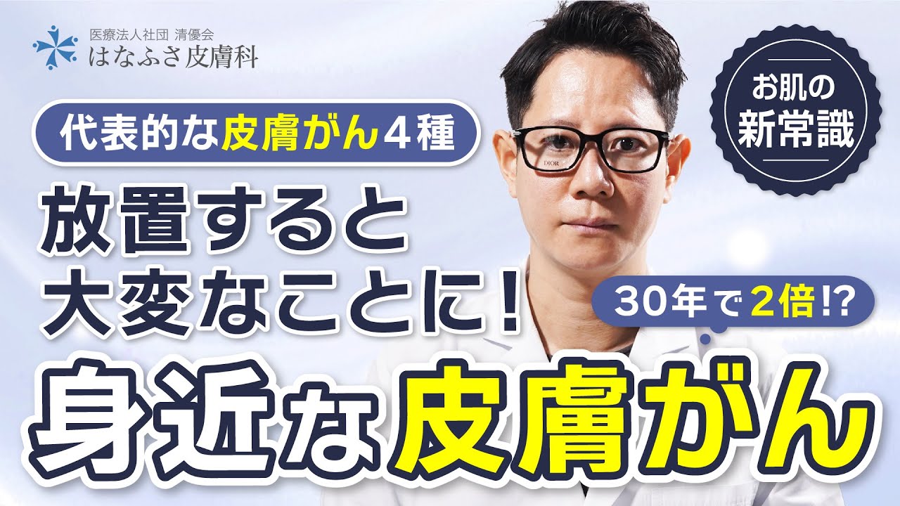 【なぜか急増中】実は身近な皮膚がんについて【基底細胞がん】【メラノーマ】