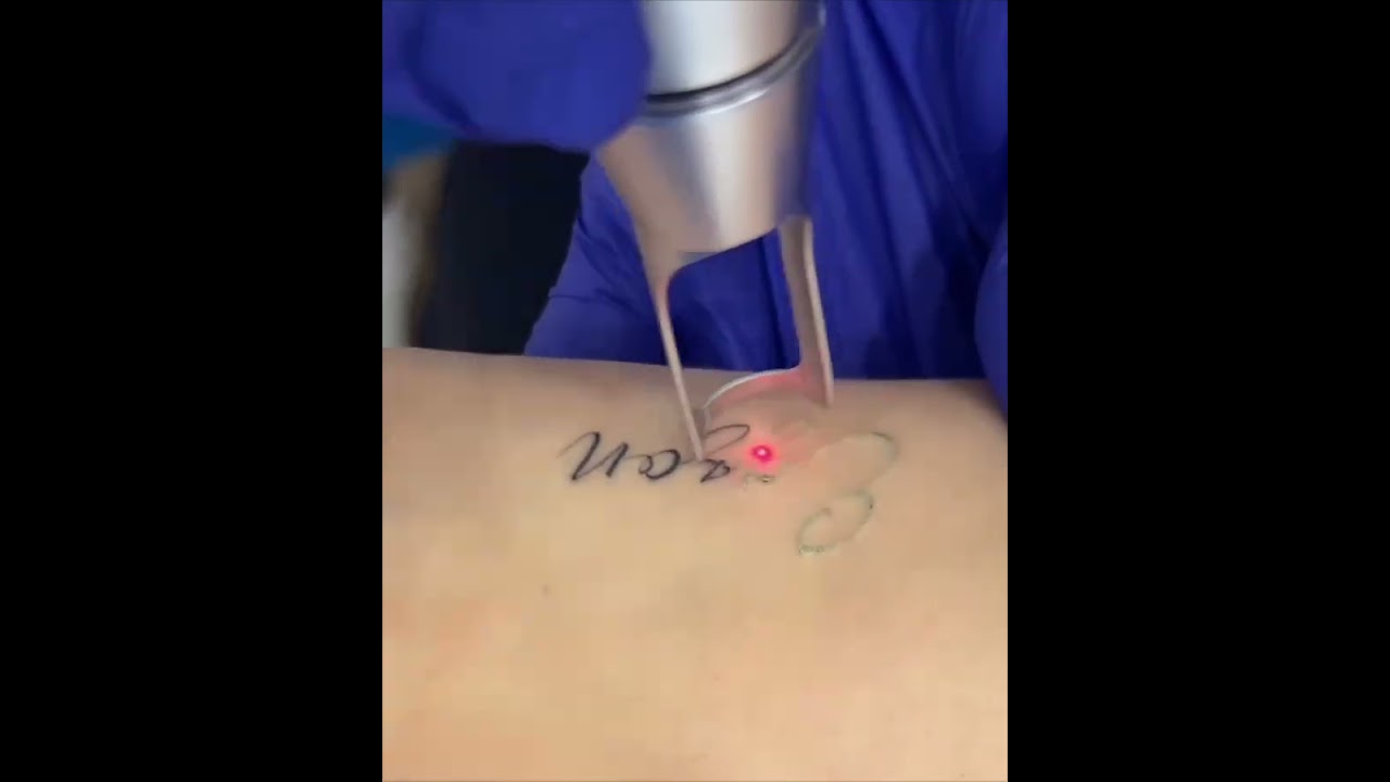 Luckytattoostudio & Lasertattooremoval ☎️7386896855 & 9951066724📍Hyd, Kukatpally, jagathgirigutta