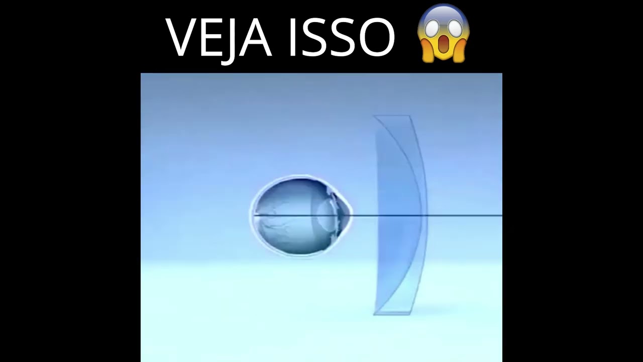 Linear Glass - &Oacute;culos Multifocal Indestrut&iacute;vel