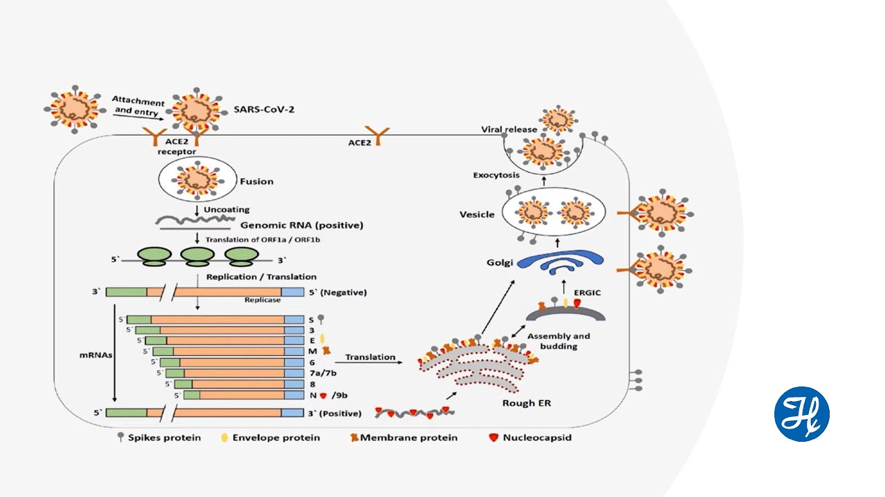 Journal Club - Atypical phenomena of COVID-19 induced ARDS