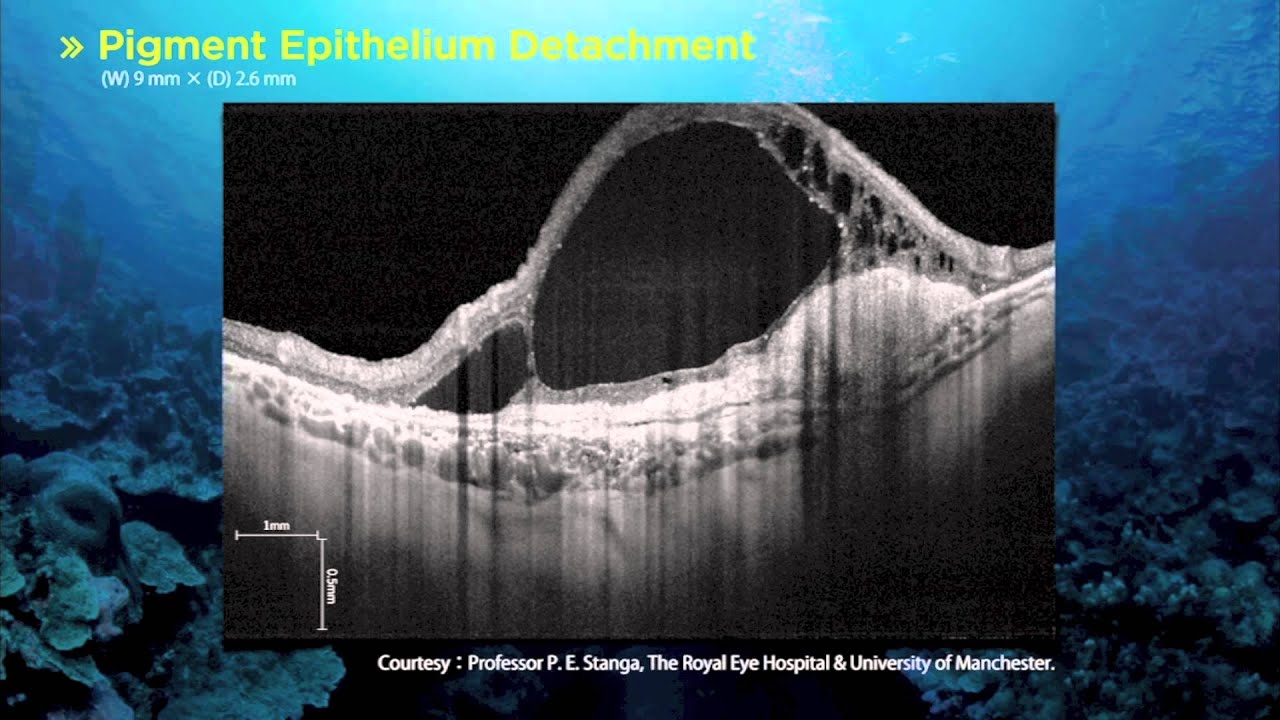 Topcon DRI OCT-1 ATLANTIS Swept Source OCT