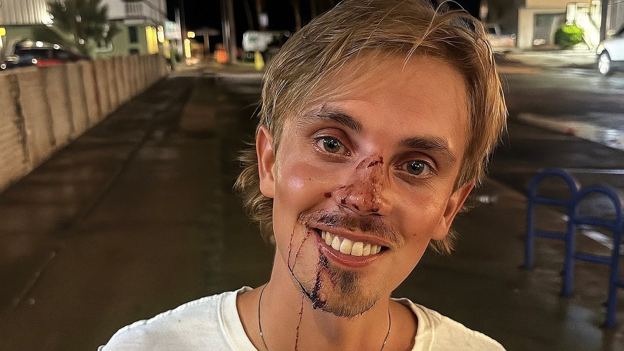 I Got Headbutted in California... *Ambulance Called*