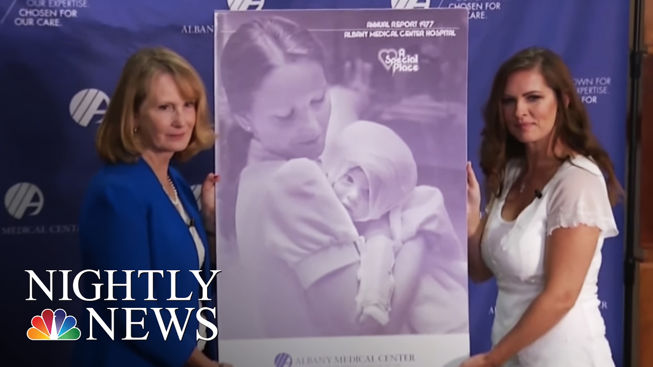 Woman Finds Nurse Who Cared For Her as an Infant Burn Victim | NBC Nightly News