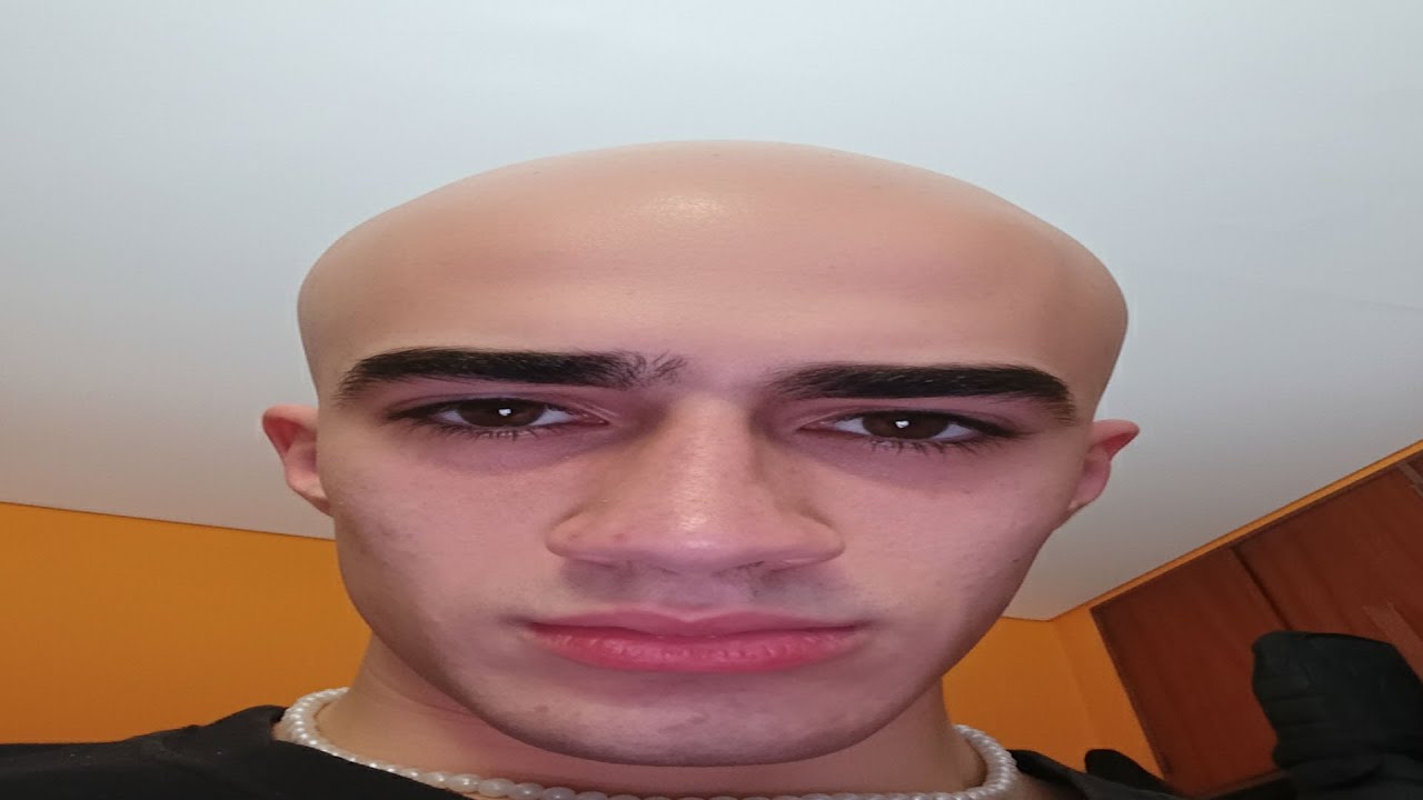 ME ESTOY QUEDANDO PELADO