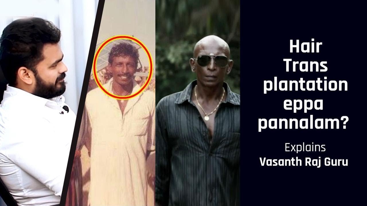 Different Stages of Balding everyone should know - Explains Vasanth Raj Guru