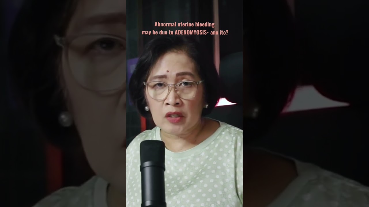 Abnormal uterine bleeding may be due to ADENOMYOSIS- ano ito?