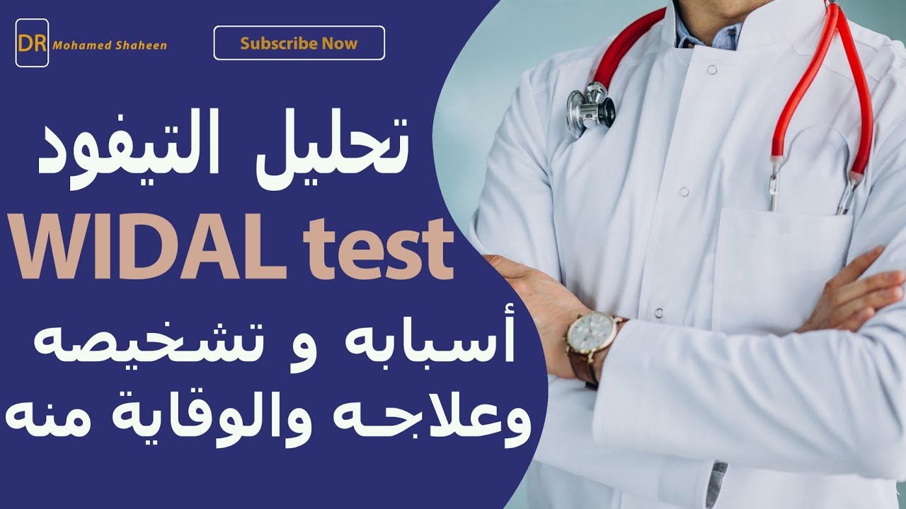 تحليل التيفويد (Widal Test): ما هو؟ ولماذا يُطلب؟