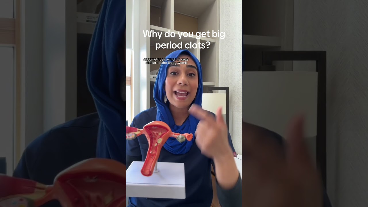Big #period clot is no small matter and what the underlying condition that need to be checked out