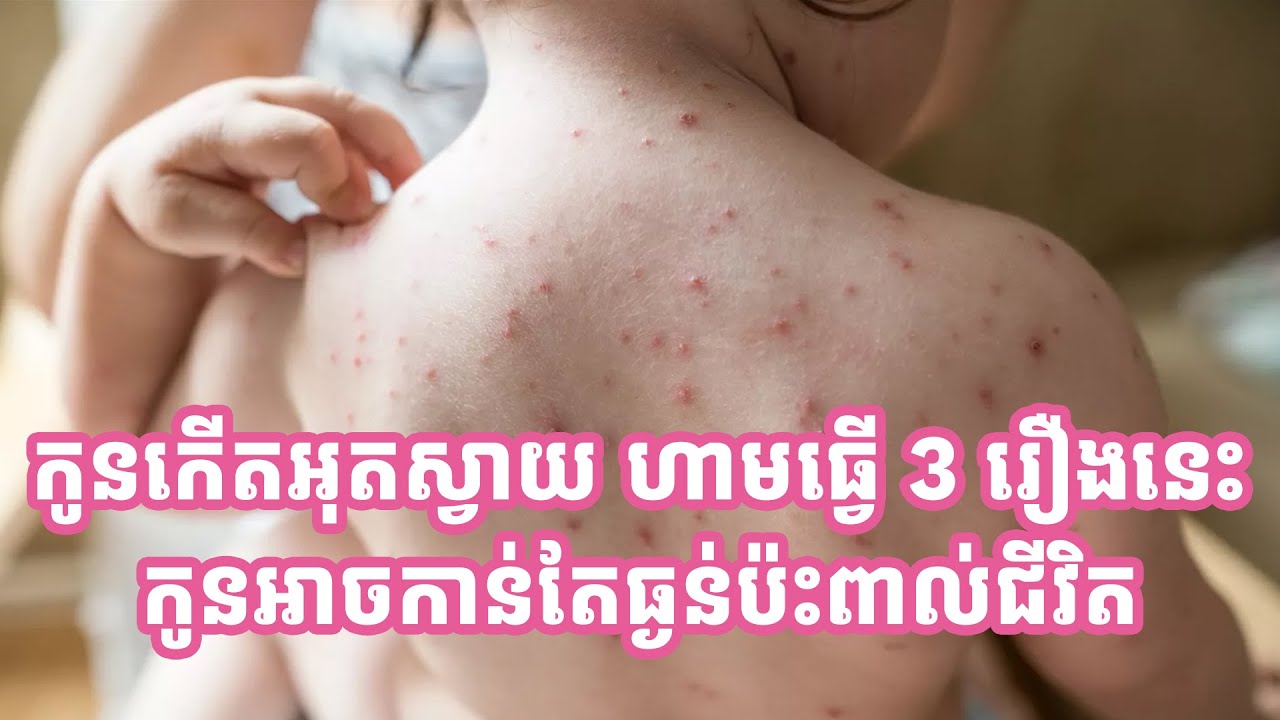 កូនកើតអុតស្វាយ ហាមធ្វើ 3 រឿងនេះ កូនអាចកាន់តែធ្ងន់ដល់រលាកសួត រលាកខួរក្បាល