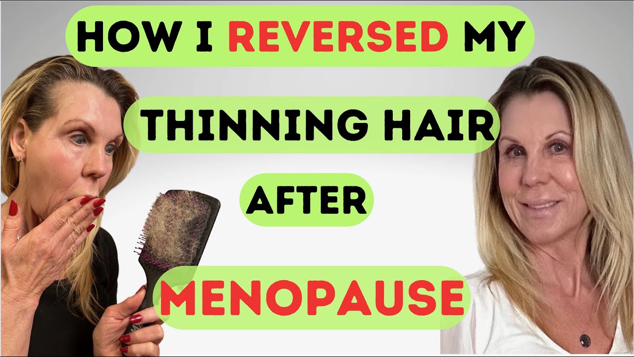 How I Reversed Extreme Hair Loss After Menopause  With These Products and Habits! (women over 55)