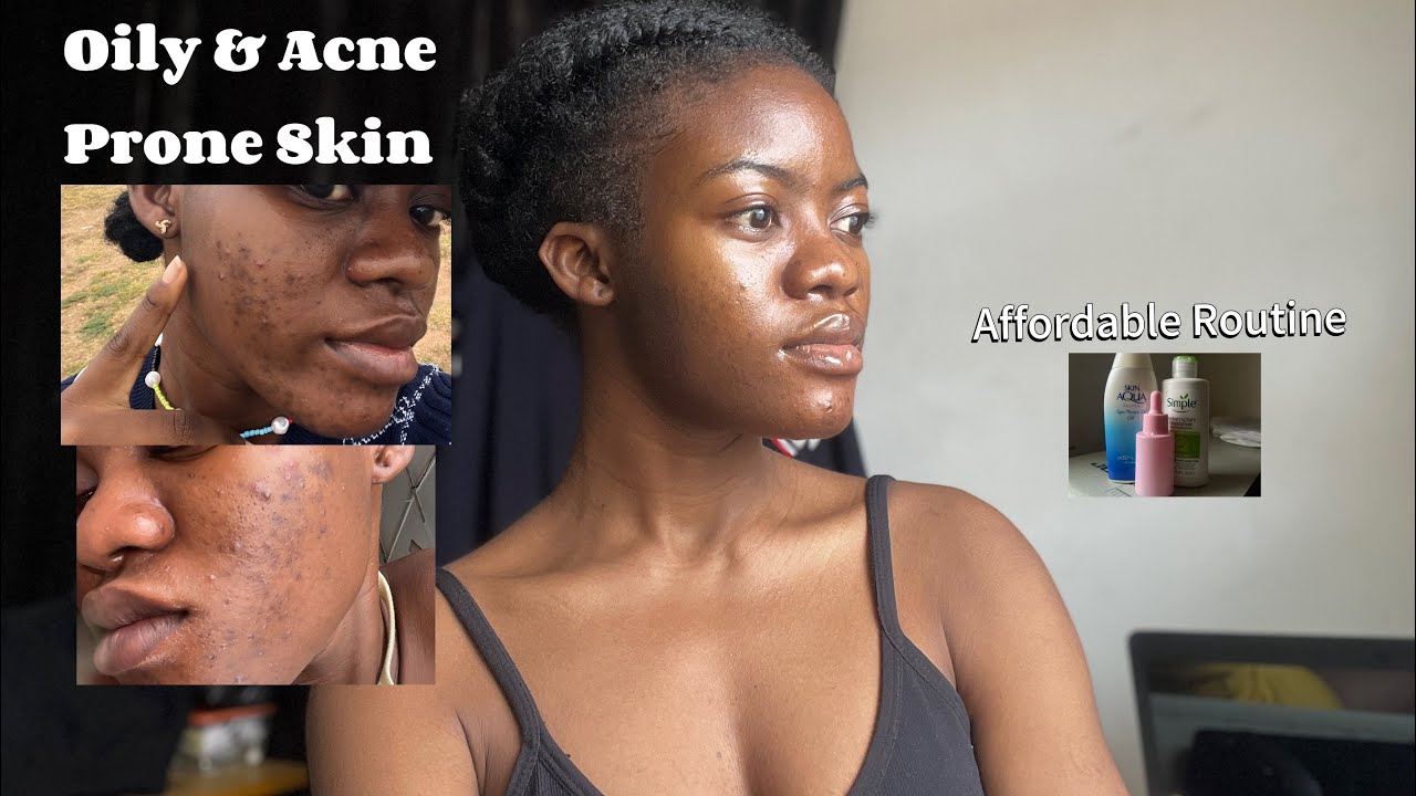 Clear Skin on a Budget / My Affordable Routine for Oily Acne-Prone Skin 