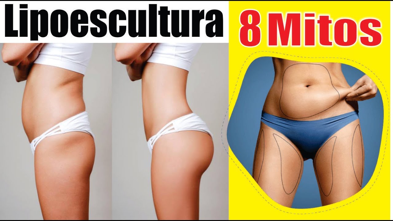 8 MITOS de la LIPOESCULTURA 👙 MENTIRAS y VERDADES sobre la LIPOSUCCIÓN ⭐ Dr ALBERTO CALVO QUIROZ