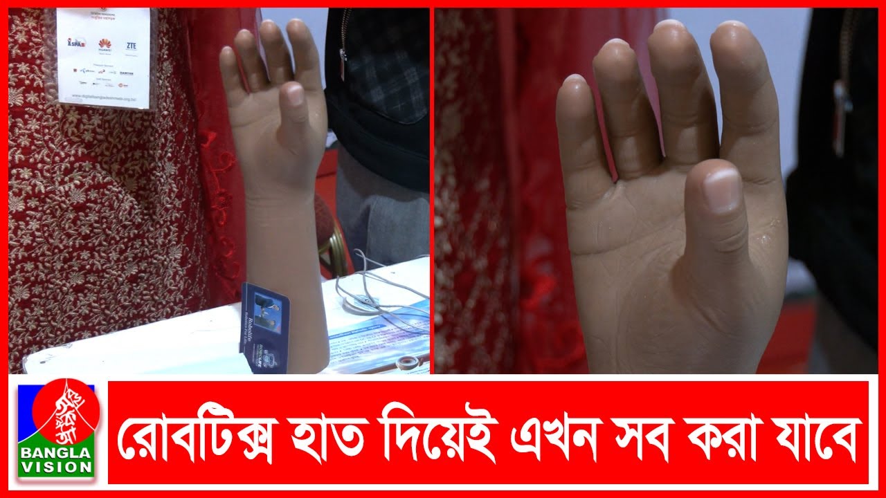 যাদের হাত নেই তারা কৃত্রিম হাত ব্যবহার করতে পারেন