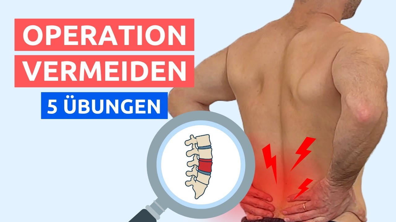 Bandscheibenvorfall ohne OP behandeln: 5 einfache &Uuml;bungen (LWS)