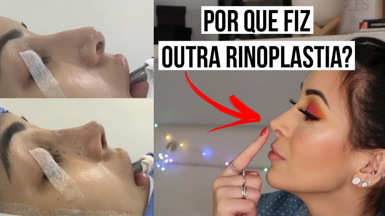MINHAS CIRURGIAS PLÁSTICAS E PROCEDIMENTOS ESTÉTICOS