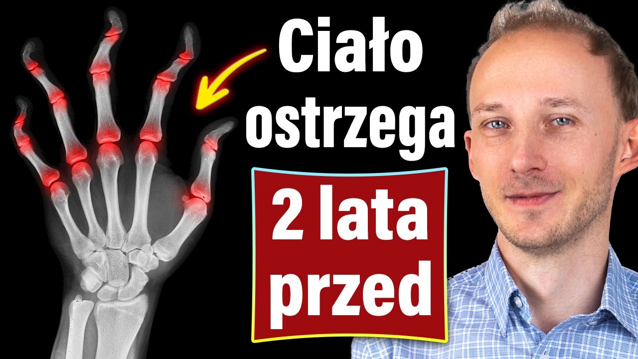 Pierwszy objaw niszczycielskiej CHOROBY STAW&Oacute;W. Działaj jak najszybciej