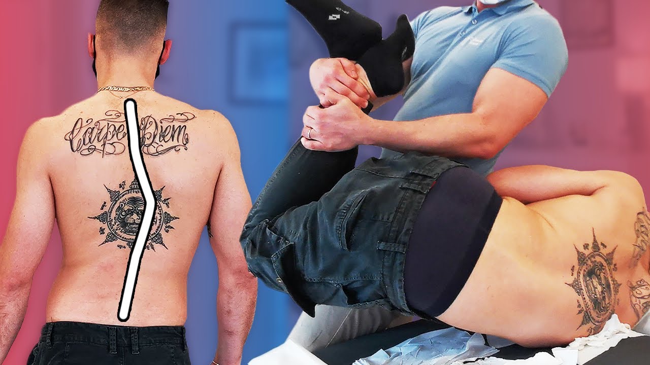 SEVERE SPINE DEFORMATION is FIXED with Chiropractic Cracking