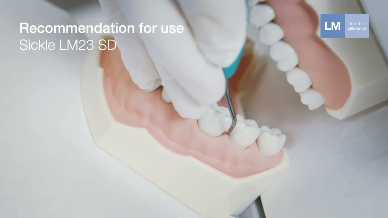 How to use Sickle LM23 SD LM™ hand instrument