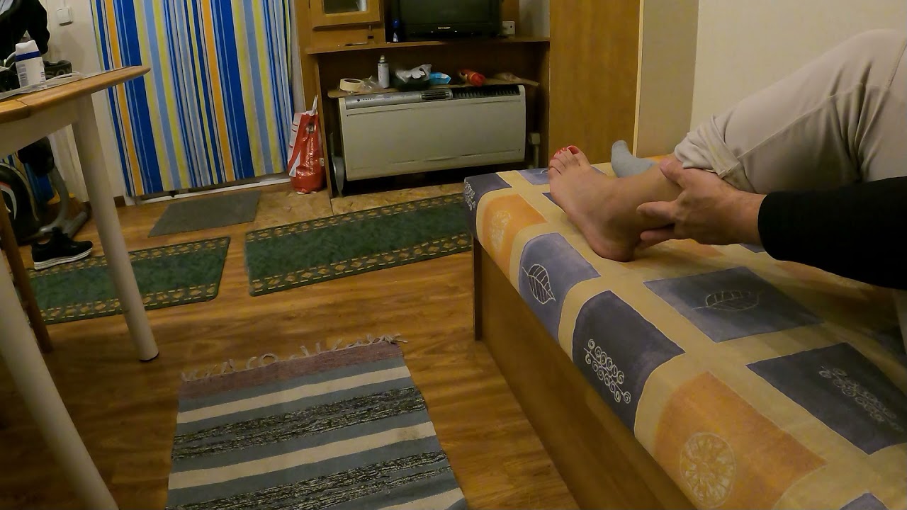 bad sprain