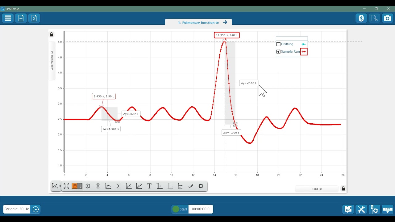 Interpret Spirometry Data (SPARKvue)