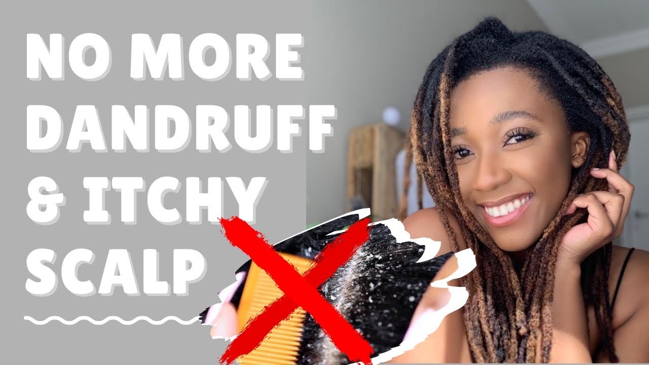 How To Treat Dry Itchy Scalp I Dandruff Treatment I Jojoba oil I Locs I Miss Kobeli