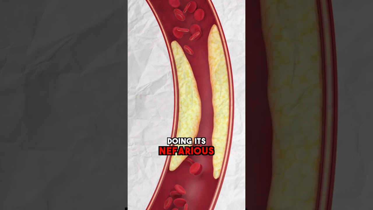 🍞 Why White Bread Is NOT GOOD for You | Dr. Joel Fuhrman #shorts