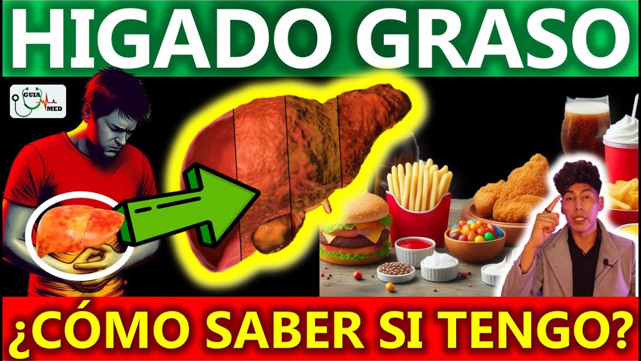 COMO SABER SI TENGO HIGADO GRASO | GuiaMed