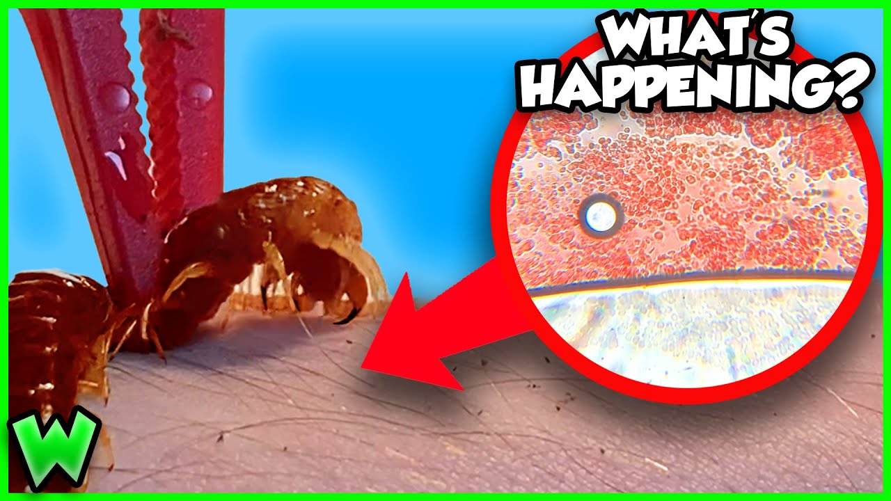 What Happens if a Centipede BITES You?