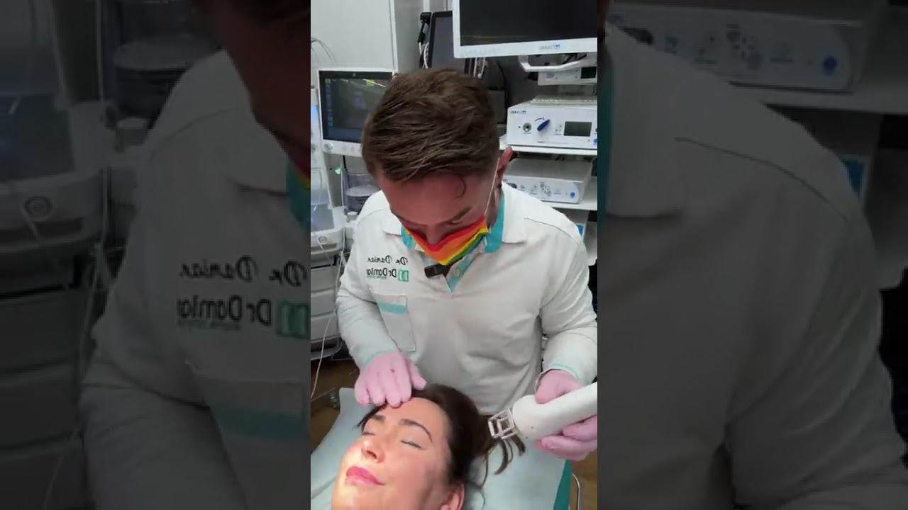 Laser tulowy 