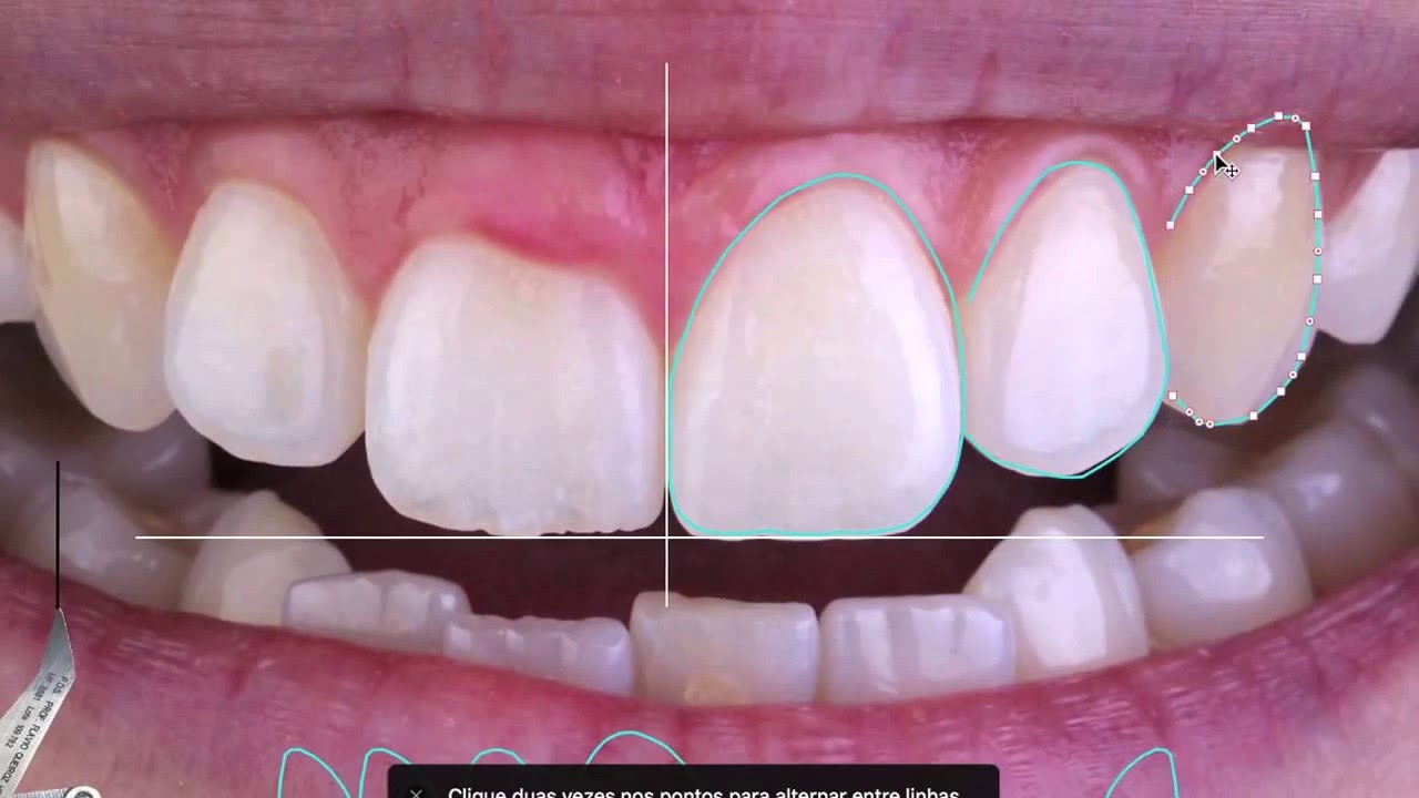 PDS em ação - Planejamento Digital do Sorriso by Prof Flavio Henriques UFF-RJ