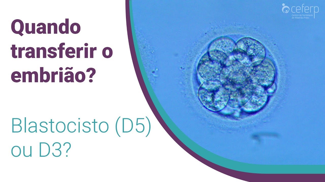 Blastocisto (D5) ou D3? | CEFERP