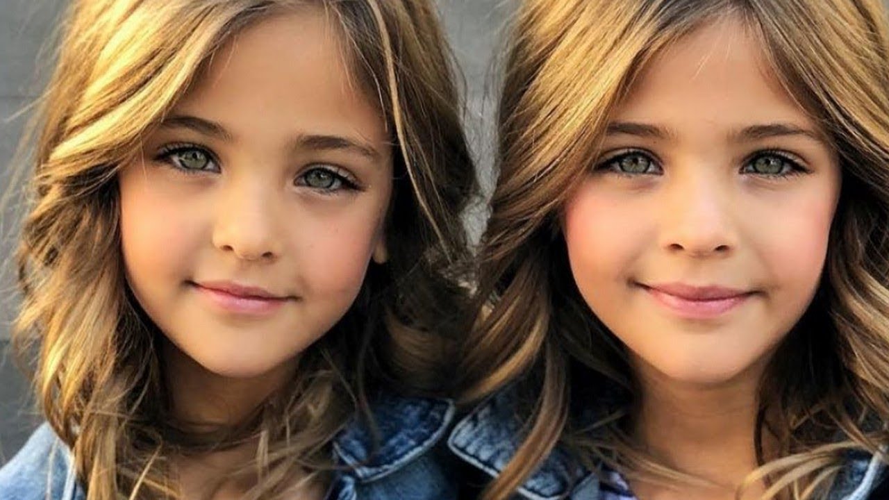 7 Ni&ntilde;os Gemelos Impactantes Que No Creeras Que Existen