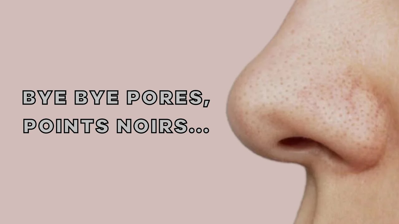 PORES DILATES, POINTS NOIRS, MICRO KYSTES, FILAMENTS SÉBACÉS…COMMENT S’EN DEBARRASSER EN 2024