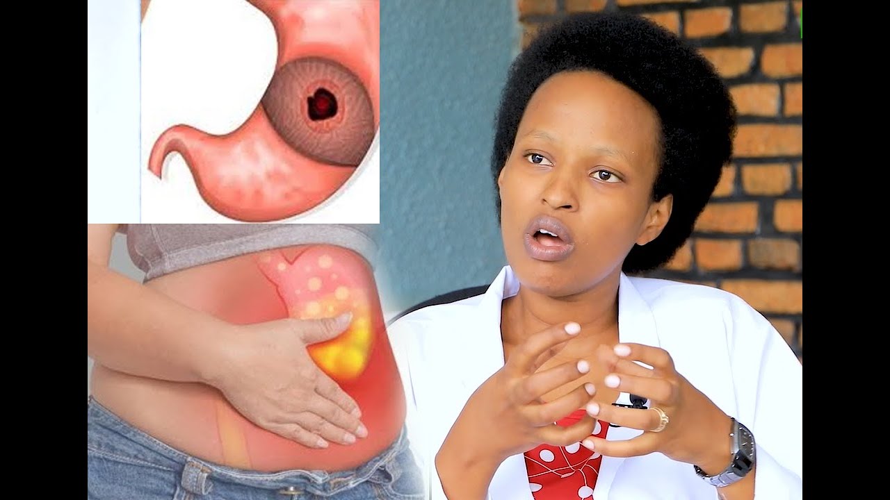 ⛔ikirungurira, ibisebe byo mu gifu, kugugara,... Ibiryo byo kwirinda bitewe n'ubwoko bw'igifu urwaye