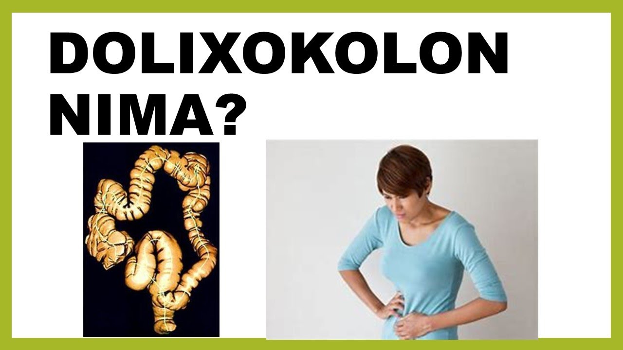 DOLIXOKOLON KASALLIGI