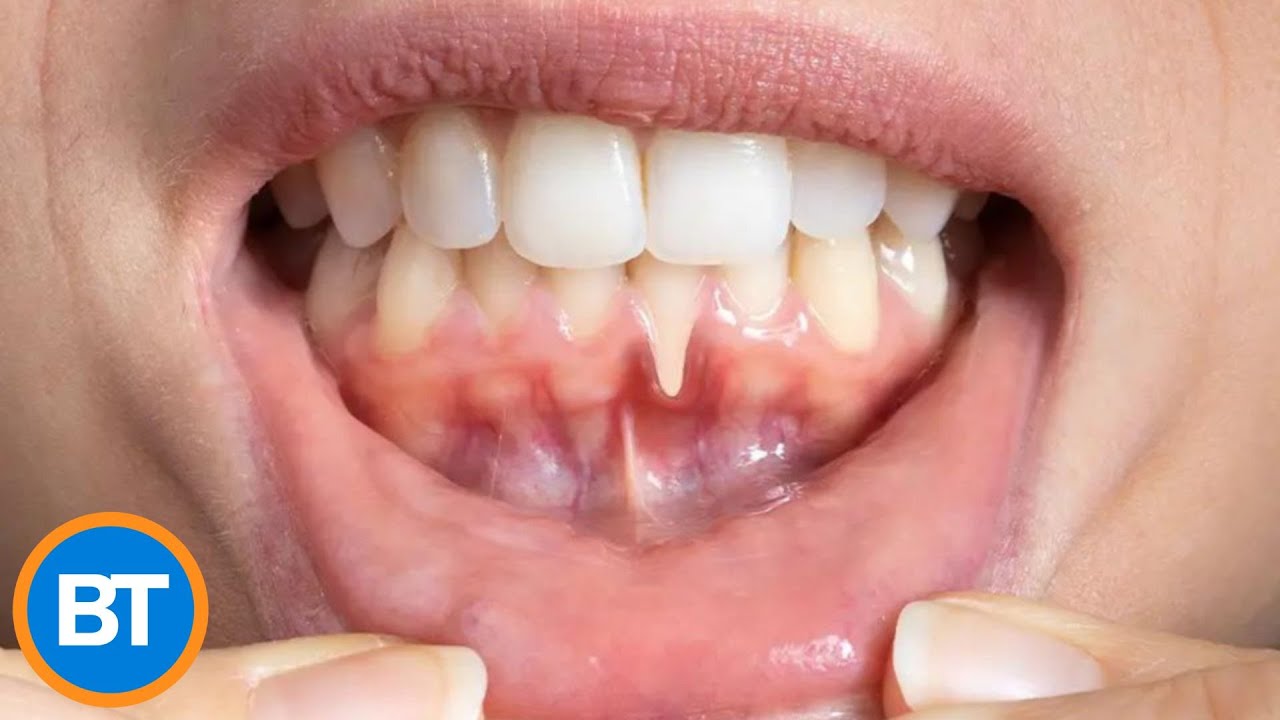 The surprising link between gum health and Alzheimer’s