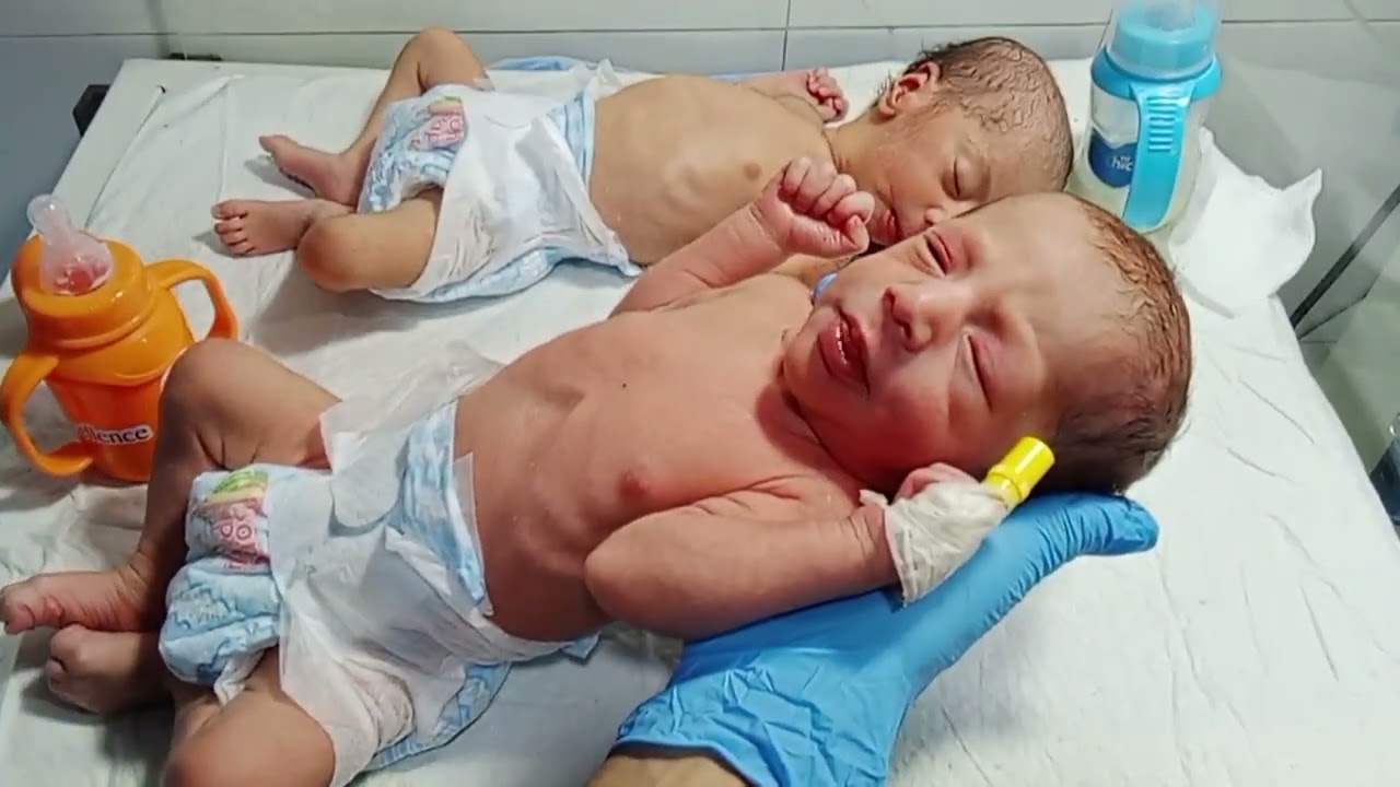 Cute Low Birth Weight Twin Babies in NICU | Feeding Care and Precious Good Moments