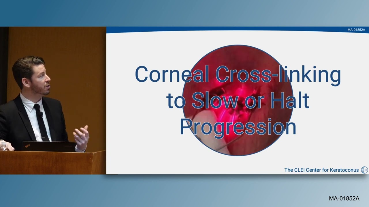 Keratoconus: What You Need to Know - Diagnostics, Cross-Linking, and Scleral Lenses