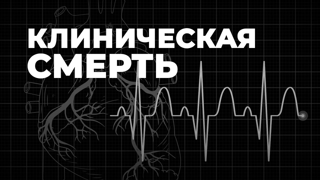 Клиническая смерть