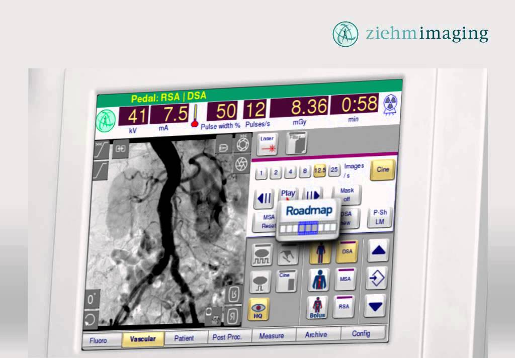 Ziehm Imaging - SmartVascular