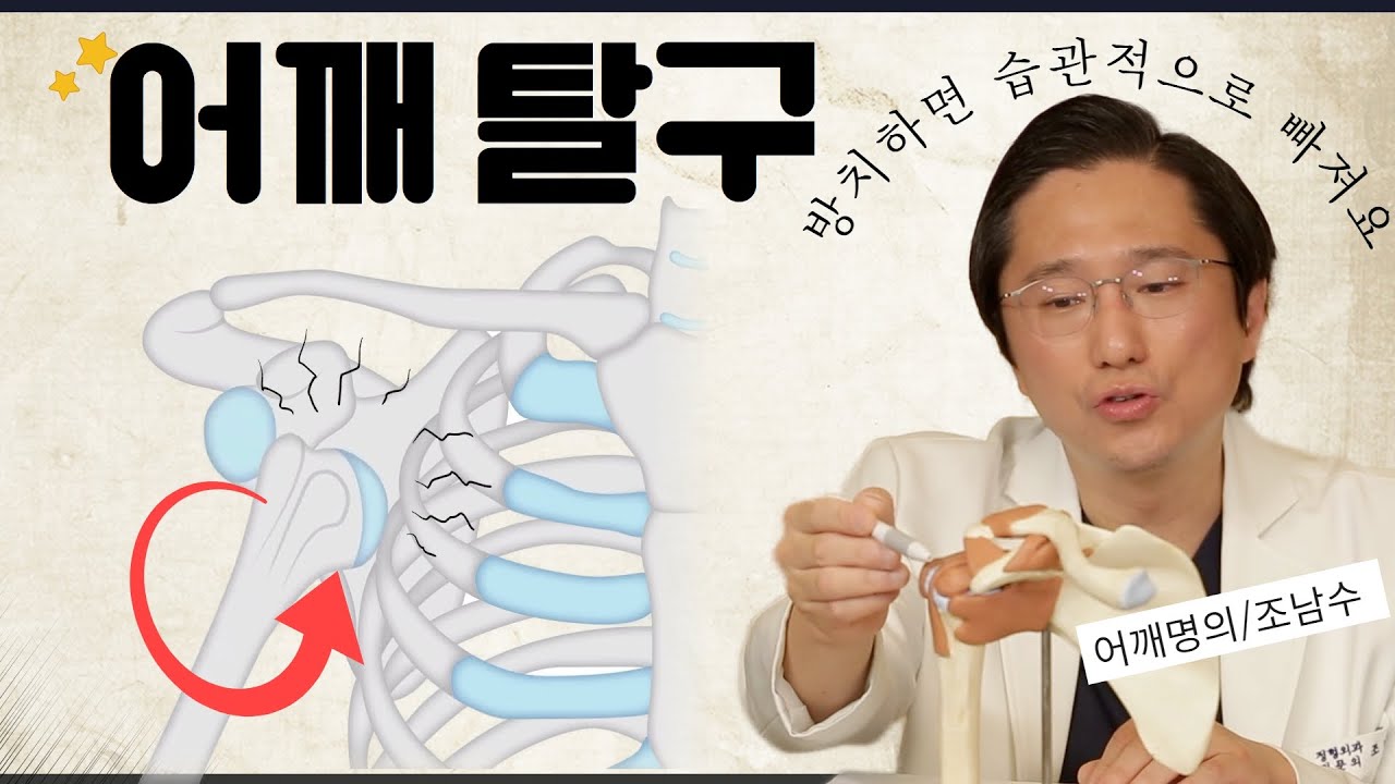 한번 빠지면 계속 빠진다?&hellip;'습관성 어깨 탈구'로 가지 않으려면 이렇게 하세요!!